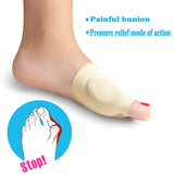 Women,Elastic,Painful,Bunion,Corrector,Breathable,Remover