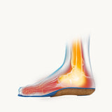 Senthmetic,Insole,Extreme,Sports,Parkour,Cushioning,Insoles