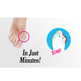 Women,Elastic,Painful,Bunion,Corrector,Breathable,Remover