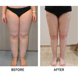 50pcs,Ginger,Detox,Patch,improve,Sleep,Health,Slimming,Patch